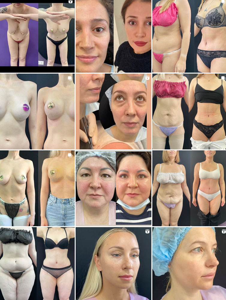 Photo & Video Editing For Aesthetic Providers