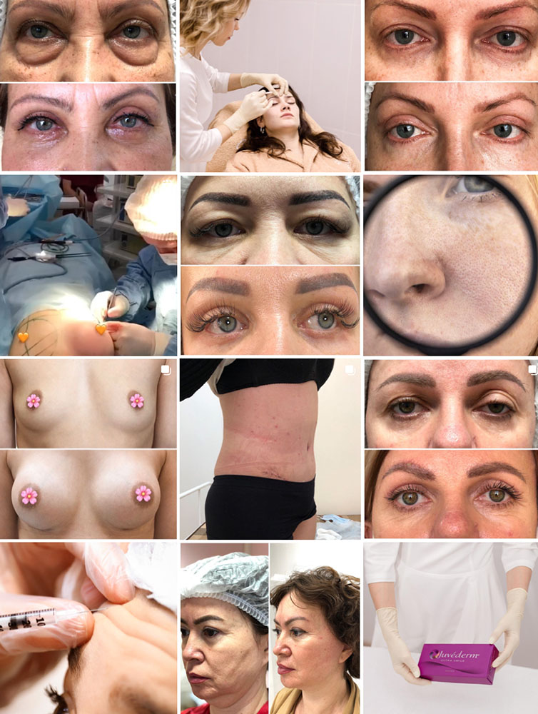 Photo & Video Editing For Aesthetic Providers