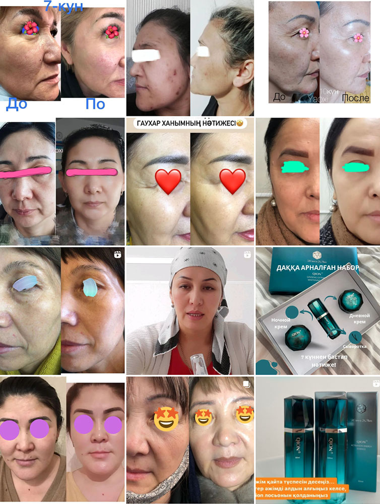 Photo & Video Editing For Aesthetic Providers