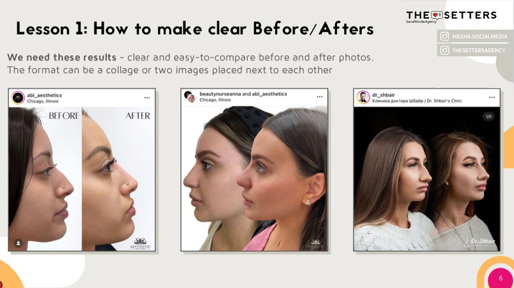 Photo & Video Editing For Aesthetic Providers