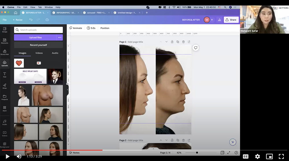 Photo & Video Editing For Aesthetic Providers
