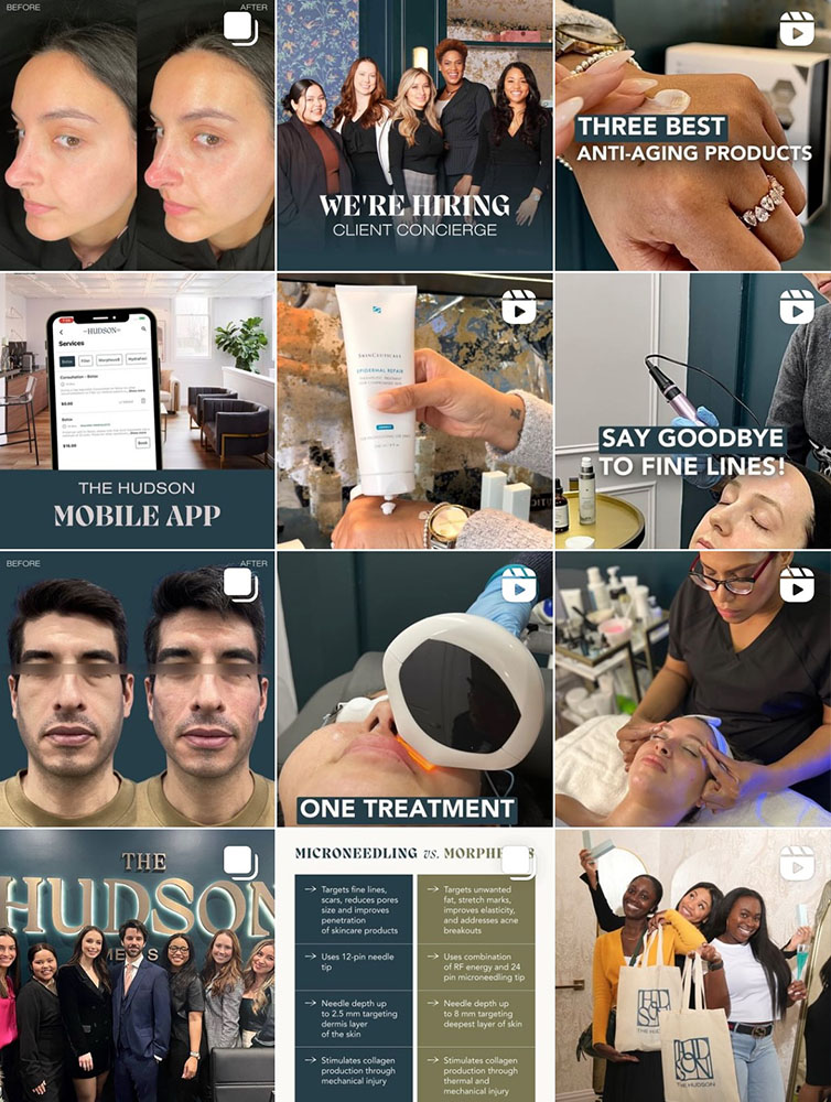 Photo & Video Editing For Aesthetic Providers