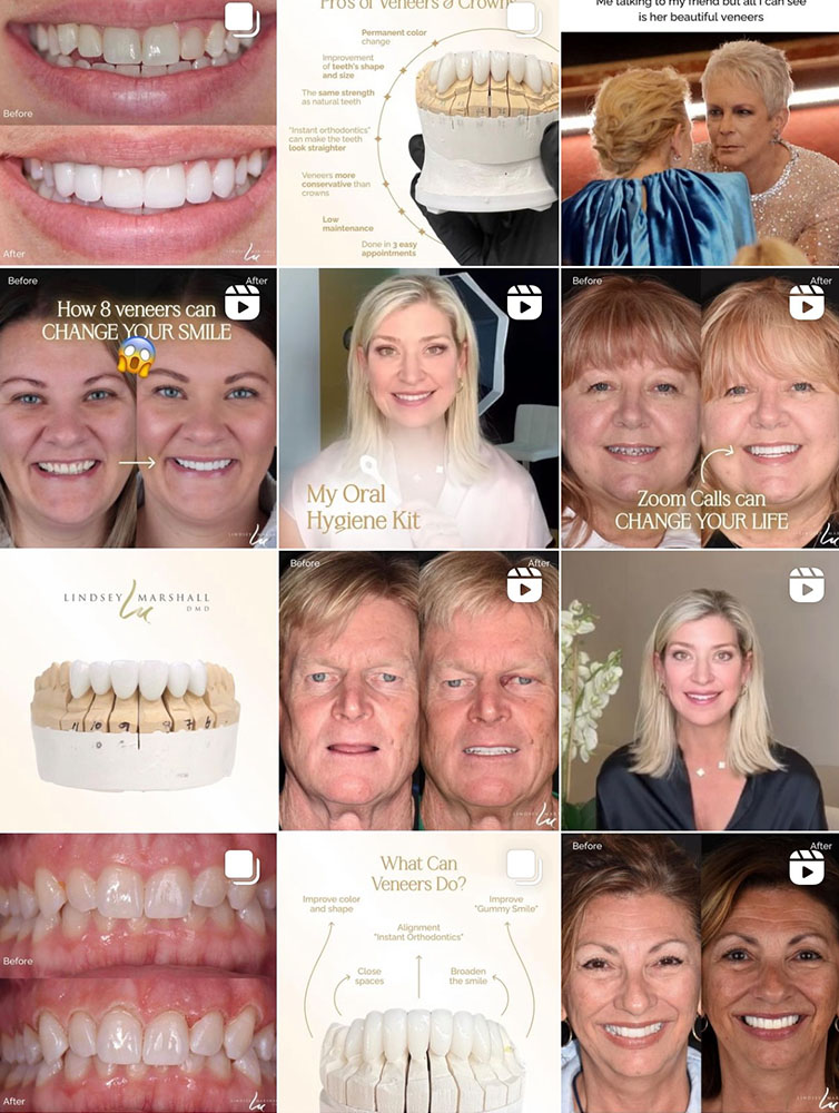 Photo & Video Editing For Aesthetic Providers